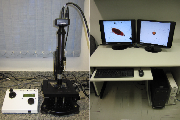 System for automatic diagnosis of parasites