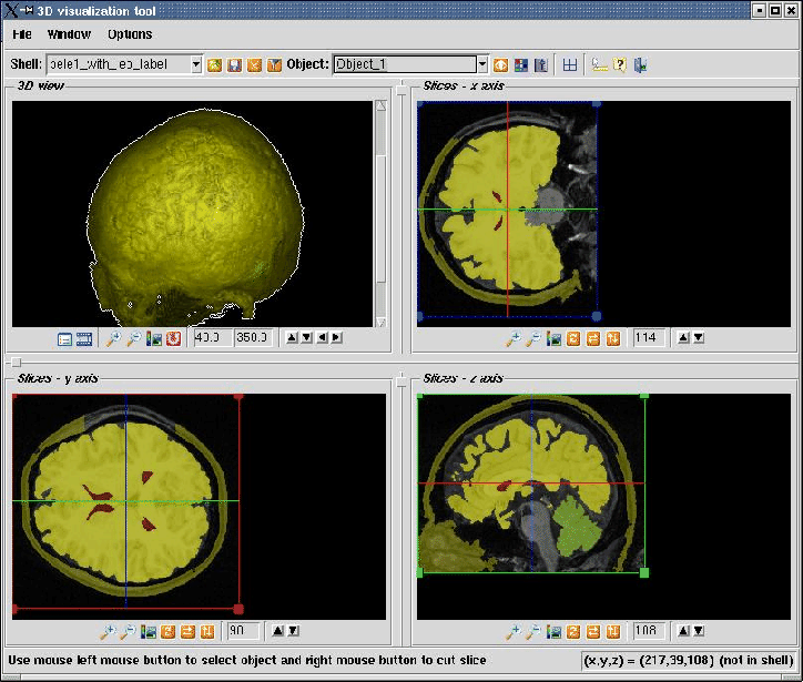 \begin{figure}\epsfxsize =16cm \centerline{ \epsfbox{fig_slices.ps}}\end{figure}