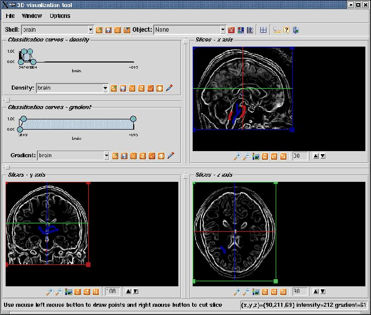 \begin{figure}\epsfxsize =16cm \centerline{ \epsfbox{fig_classificacao.ps}}\end{figure}